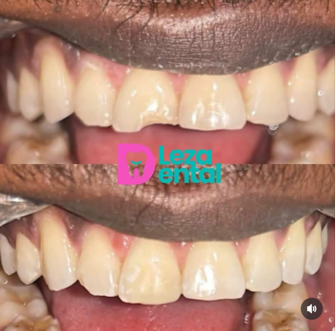 Before & After